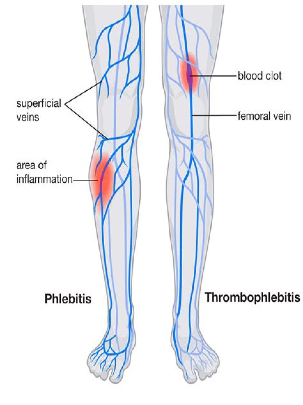 Can you feel blood rushing through your legs?