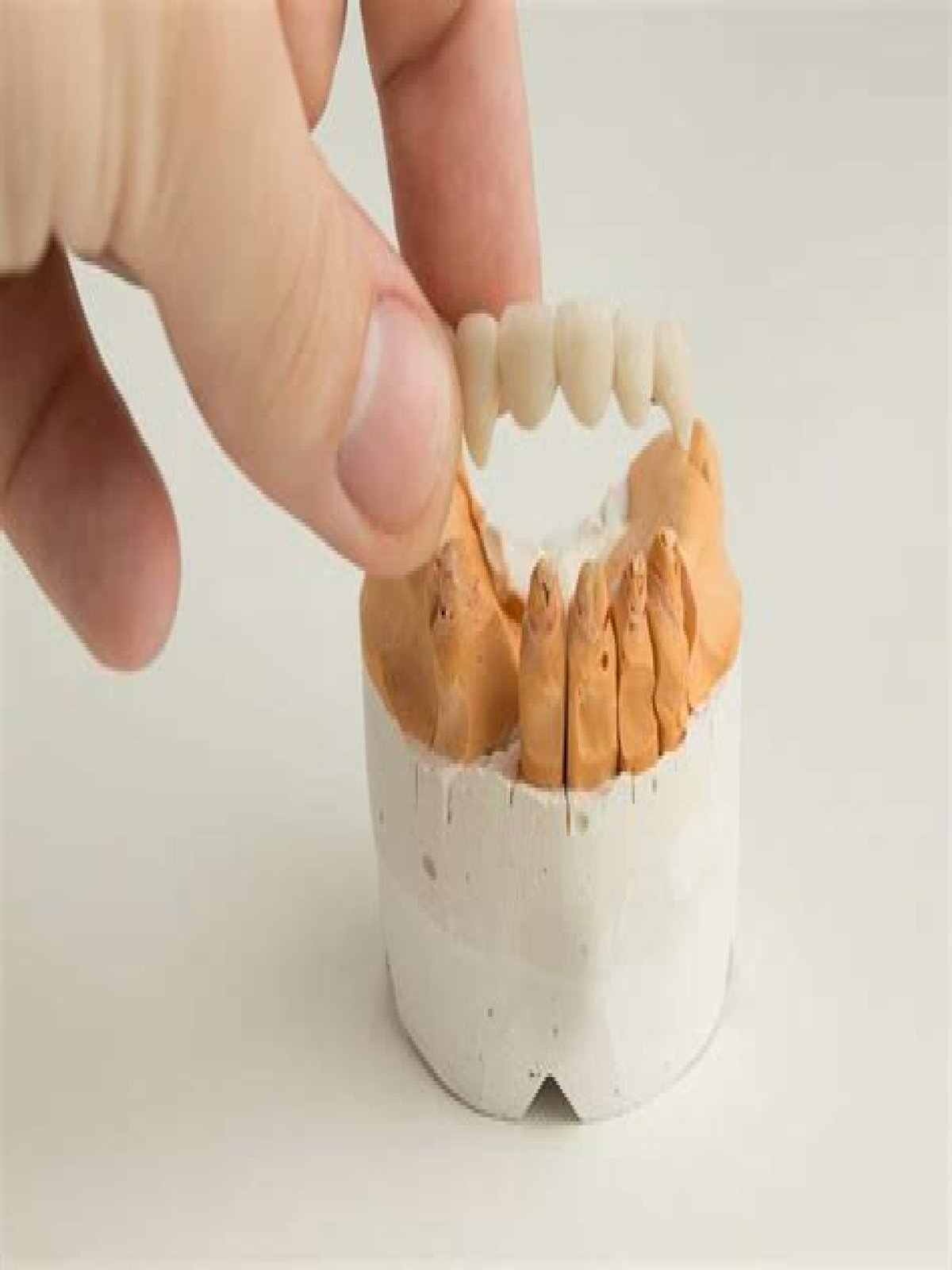 How often do crowns fall out?