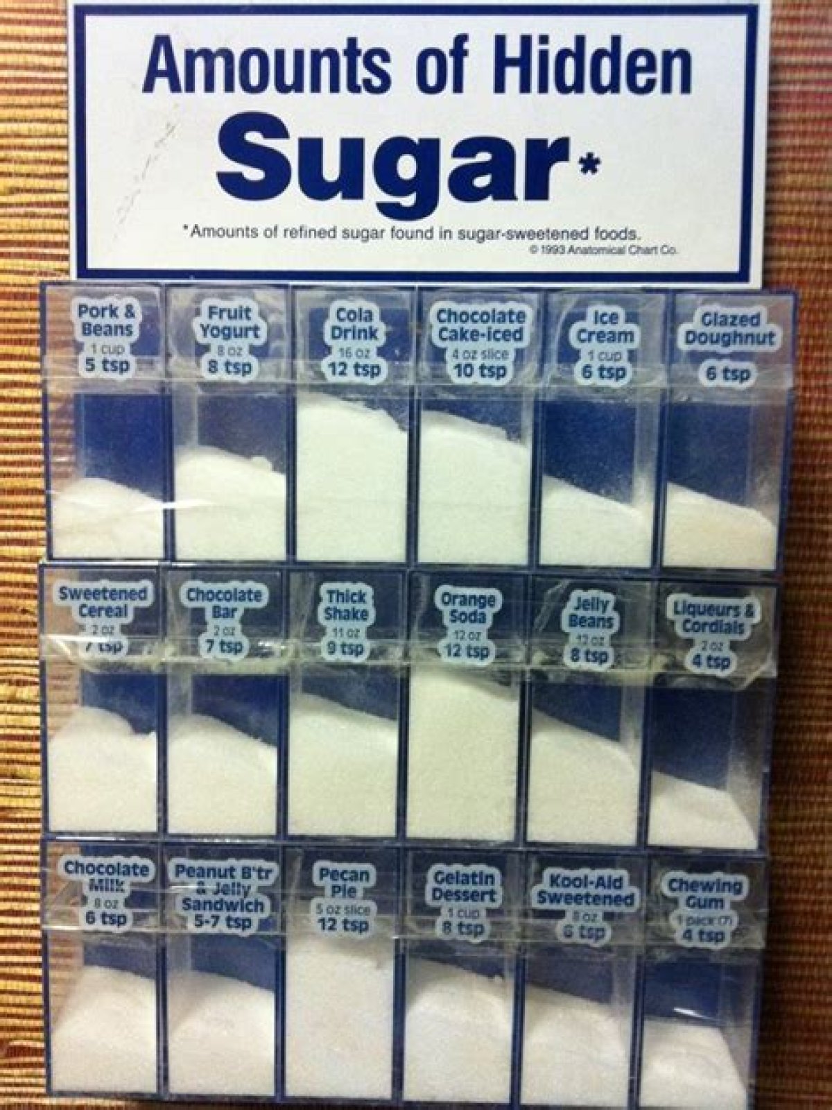 Is 20g of sugar a lot?