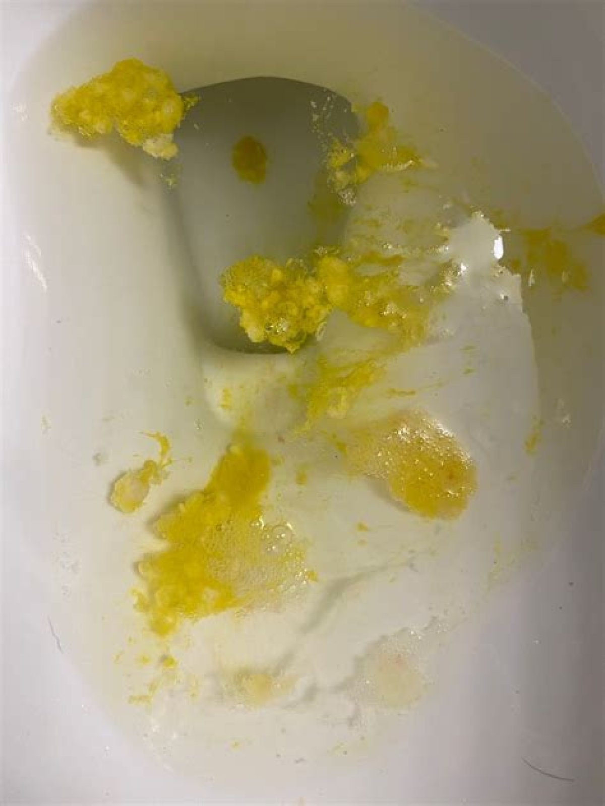 Why am I puking yellow after drinking?